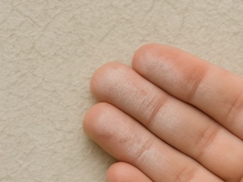 【現場ブログ】愛西市・K様邸 外壁調査の結果、チョーキングとコケが確認されました