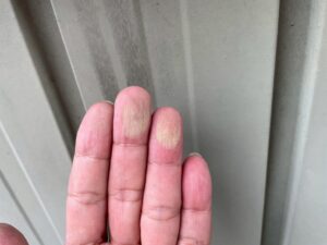 愛西市 O様邸 付帯部の塗膜劣化